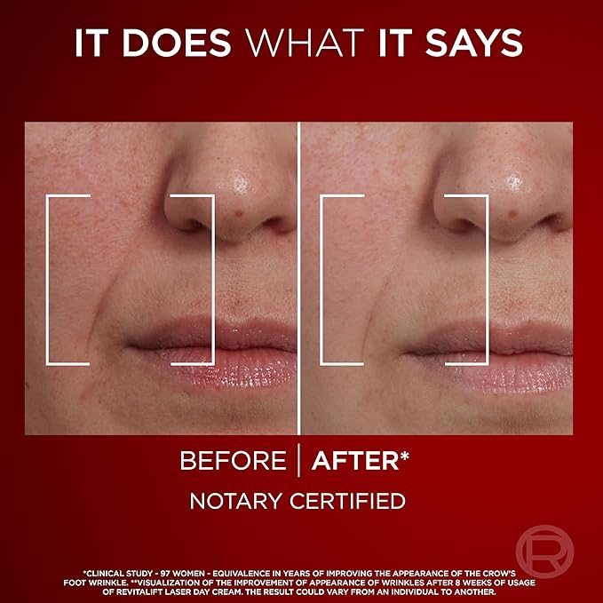 Revitalift Laser Triple Action Night Cream