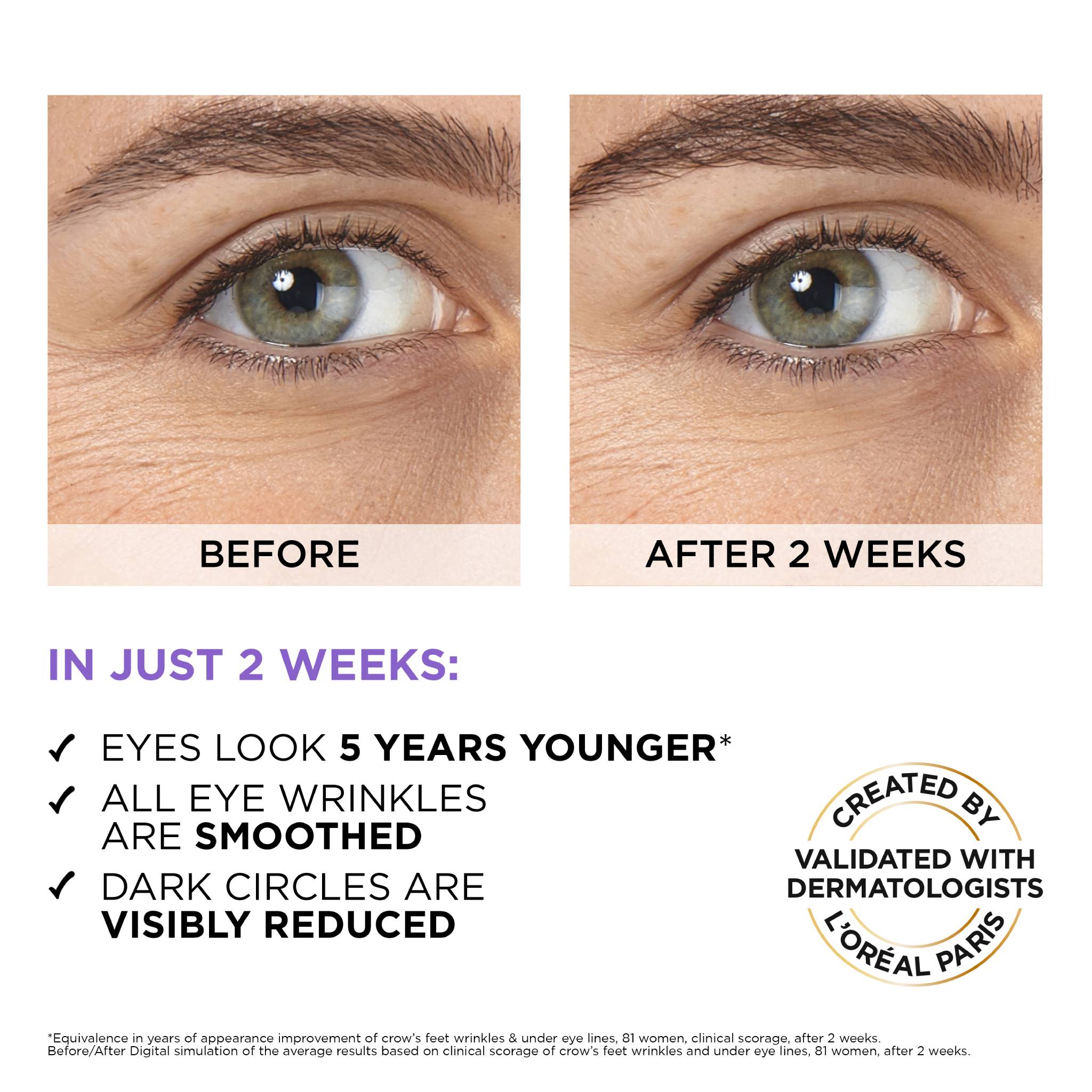 Hyaluron Expert Moisturiser and Anti-Aging Eye Serum with 2.5% Hyaluronic Acid & Caffeine