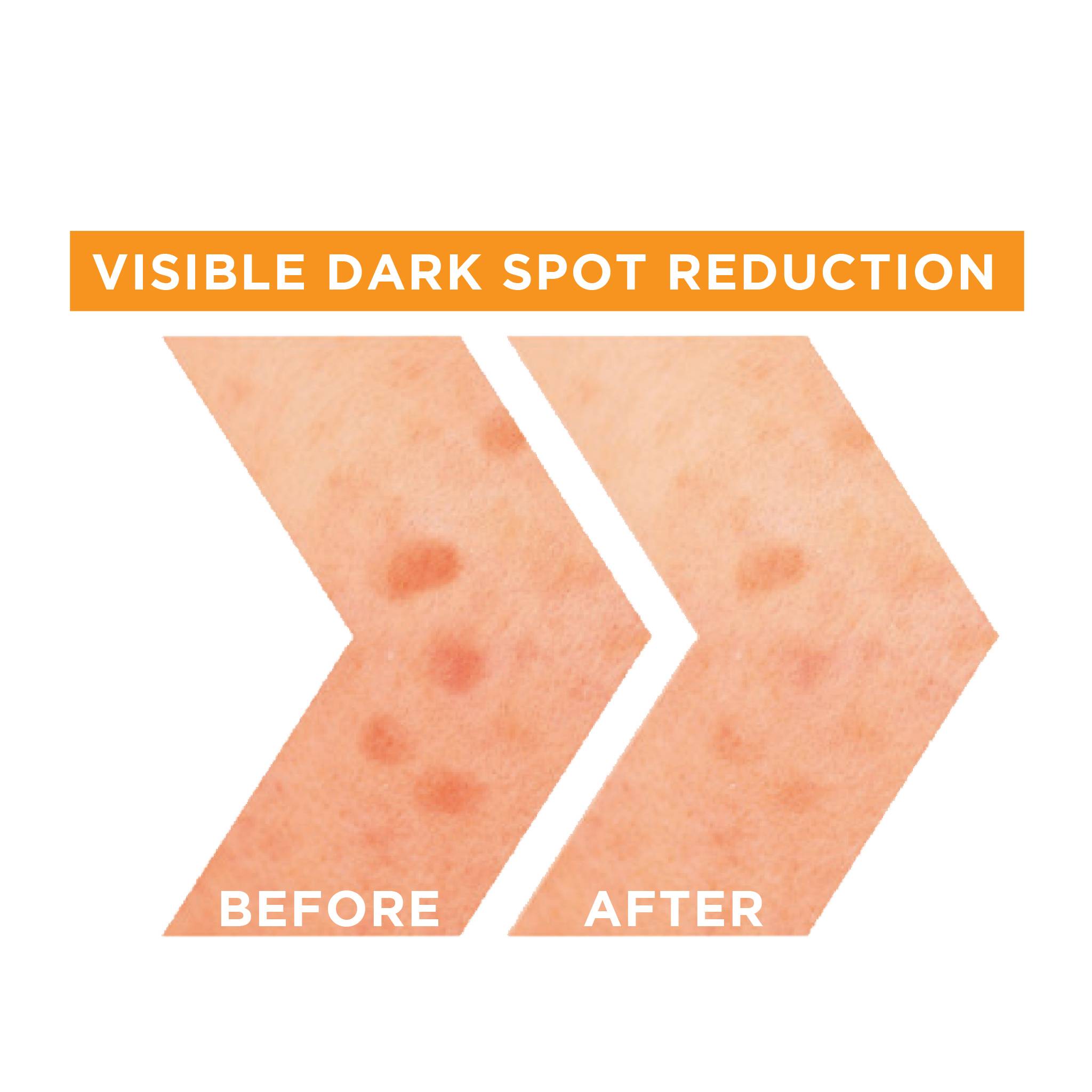 Skin Active Fast Bright Vitamin C + Niacinamide 30x Brightening Booster Day Serum