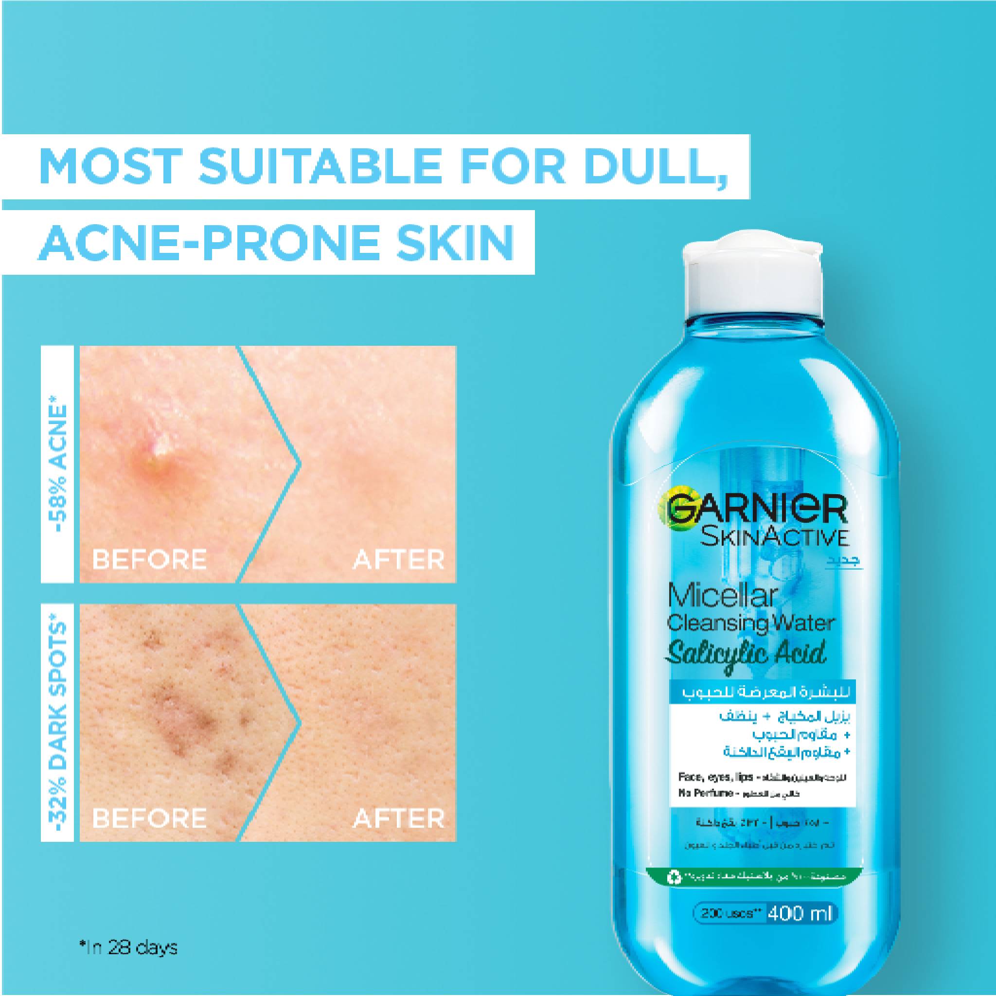 Fast Clear Micellar Water With Salicylic Acid For Acne Prone Skin