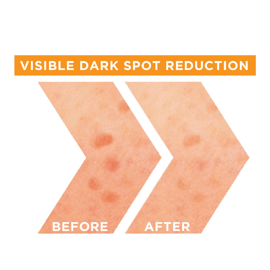 Skin Active Fast Bright Vitamin C + Niacinamide 30x Brightening Booster Day Serum