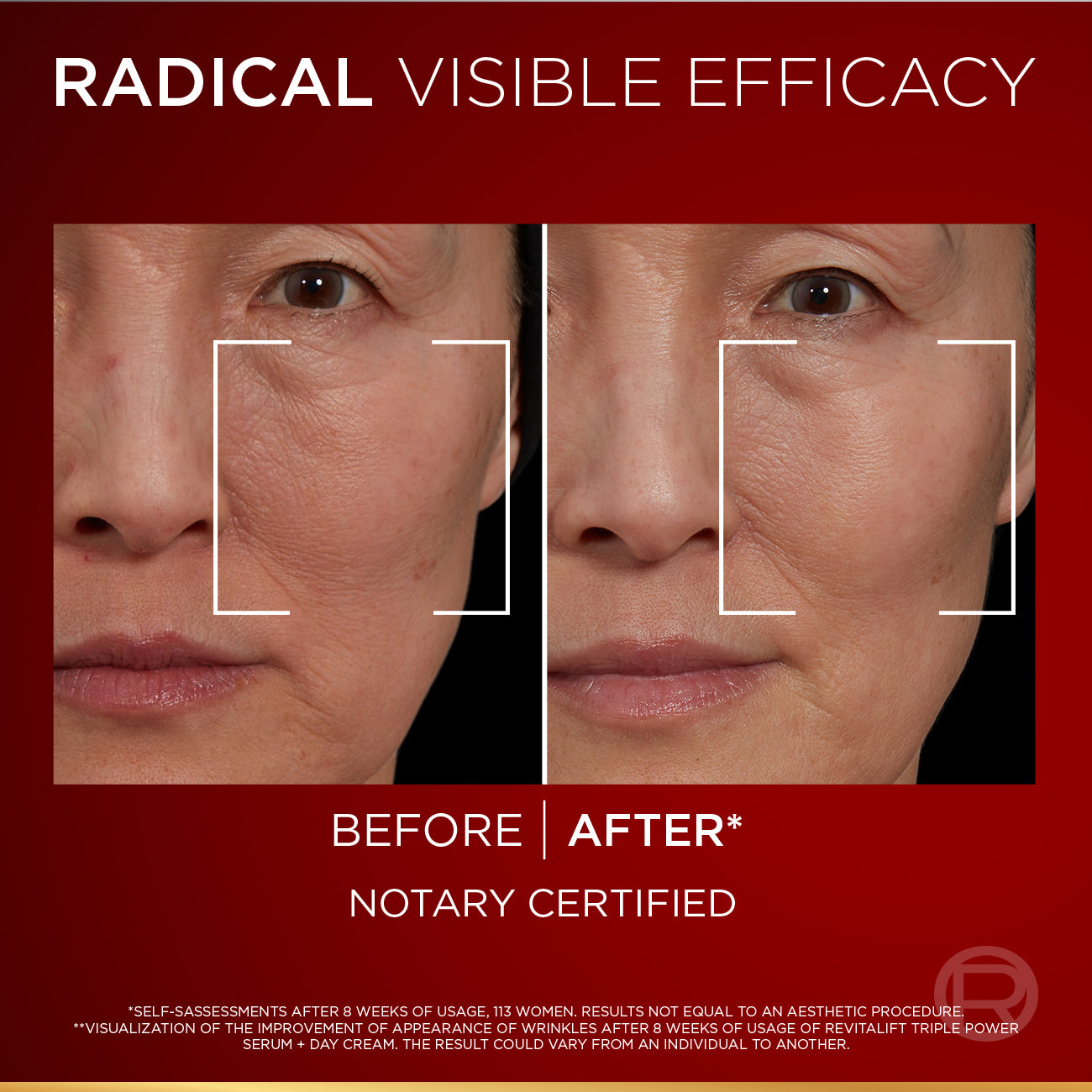 Revitalift Laser Tri-Peptides Serum