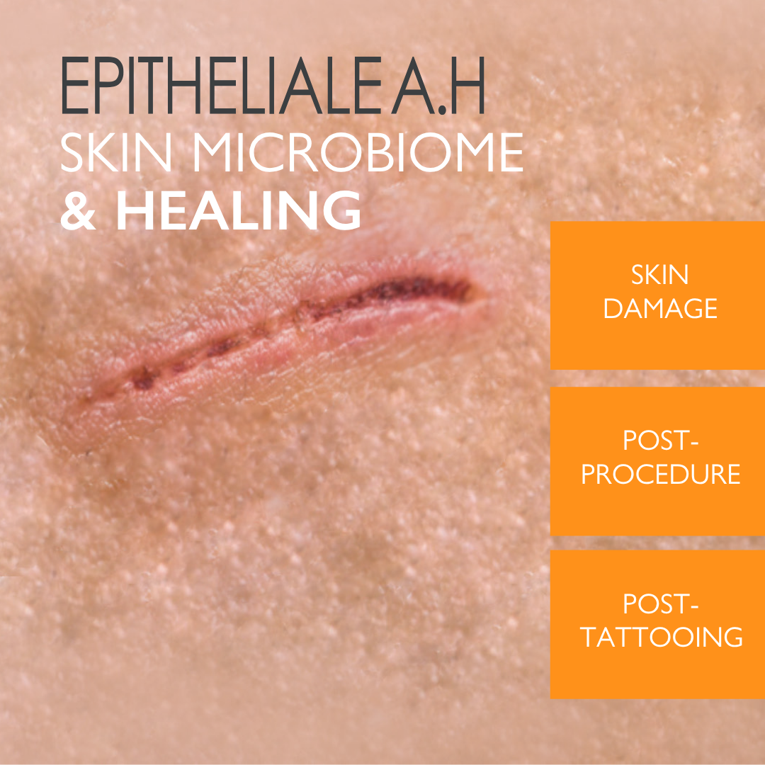 Buy One Get One A-Derma Epitheliale AH Ultra Anti-mark Ultra Repairing cream 40ml