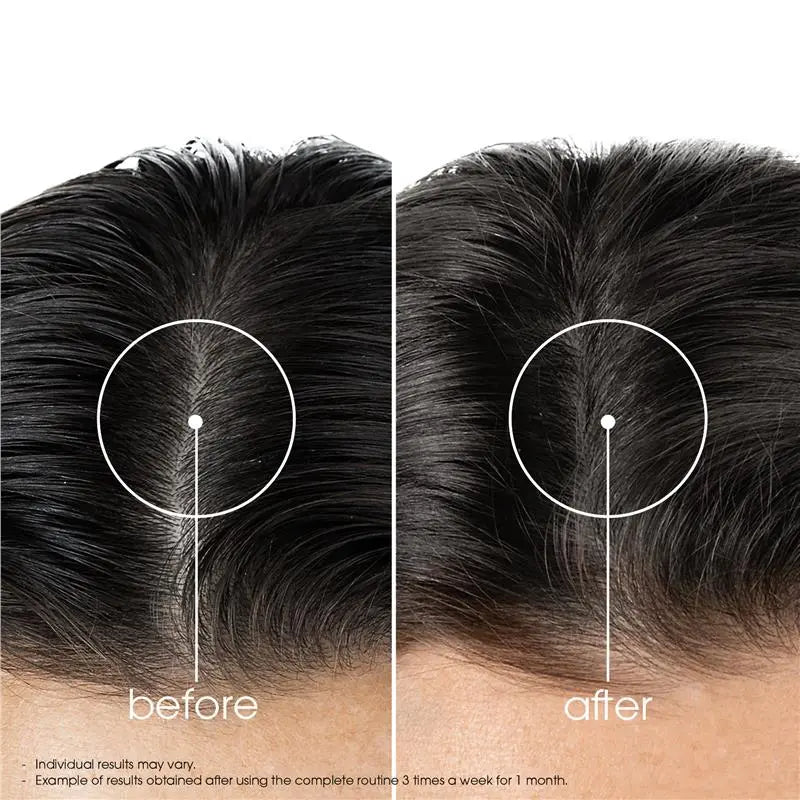 Fortifying Quinine Shampoo