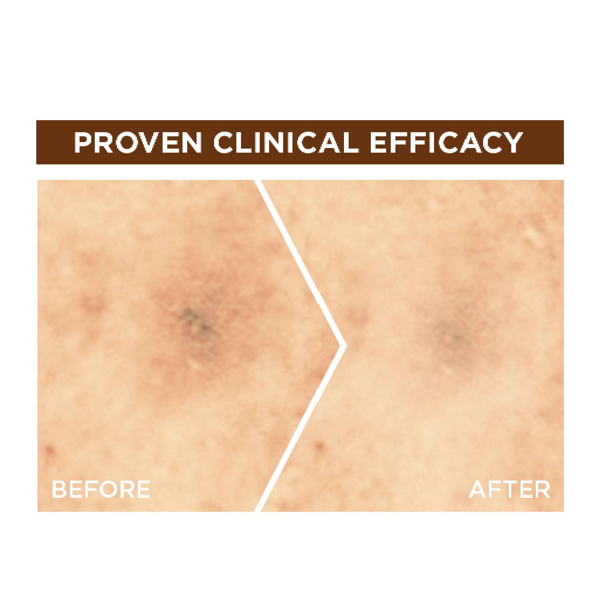 Fast Bright 10% Pure Vitamin C Brightening Overnight Serum