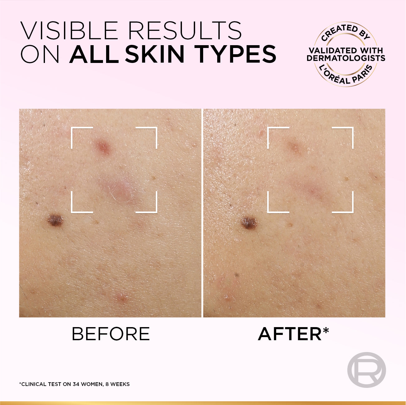 Glycolic-Bright Anti-Dark Spot Exfoliant Peel